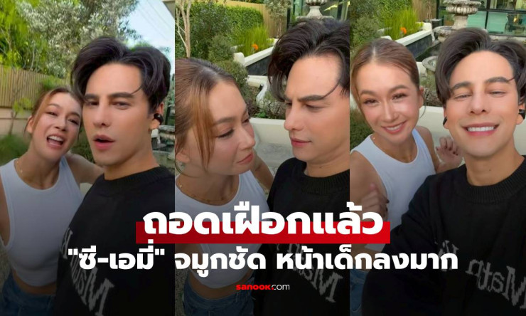 ซี-เอมี่ ถอดเฝือกแล้ว ศัลยกรรมแพ็กคู่ จมูกชัด หน้าเด็กลงมาก